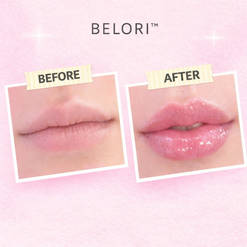 Belori™ Lip Plumper